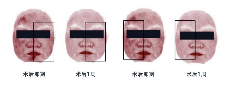 图表-26