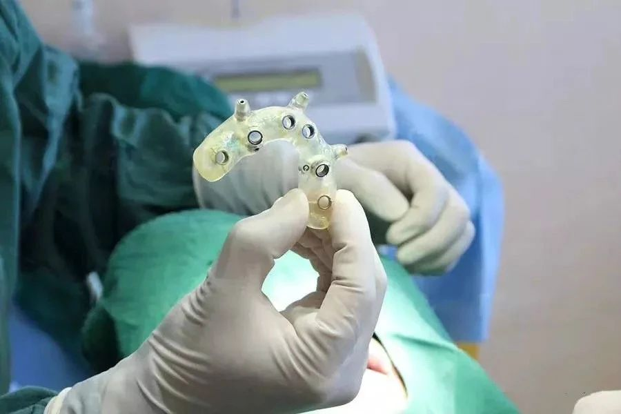 植得口腔荥阳院区医疗院长孙泽华揭秘3D数字化导板种植如何精准守护缺牙健康